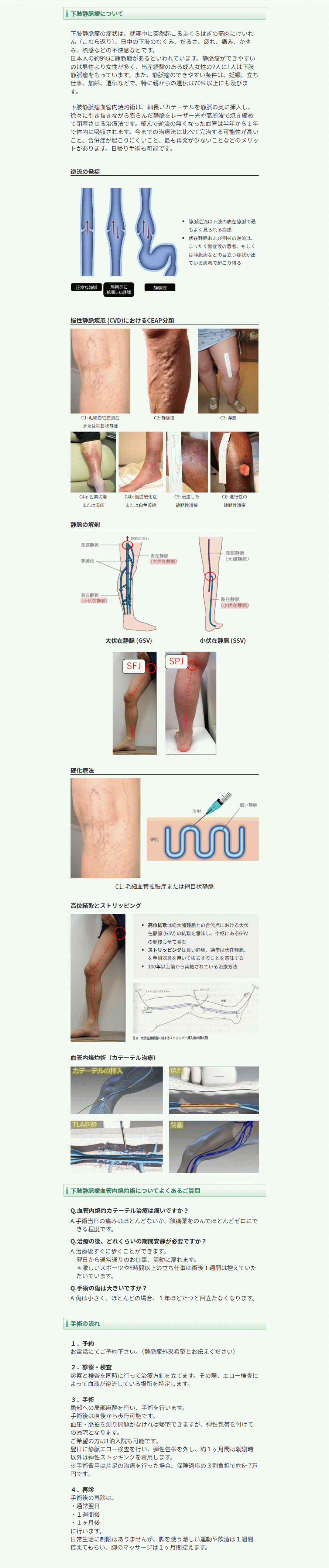 ＜下肢静脈瘤治療＞